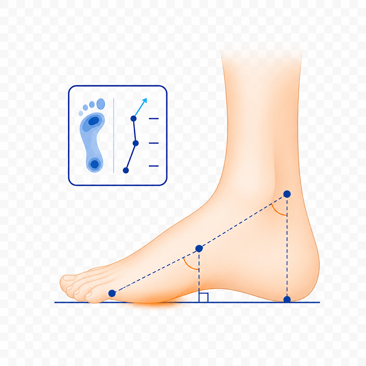 Biomechanisch onderzoek Rondom