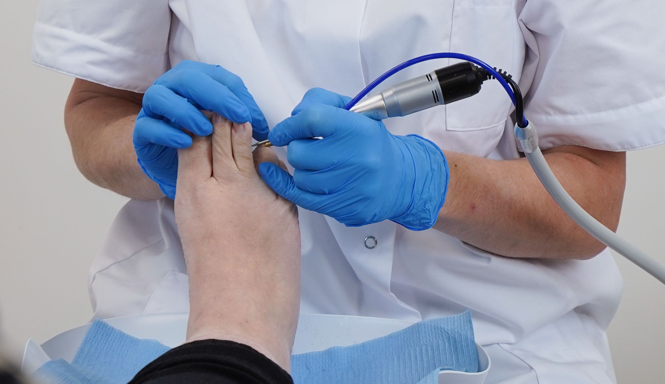 Hoe verloopt uw bezoek aan de medisch pedicure?