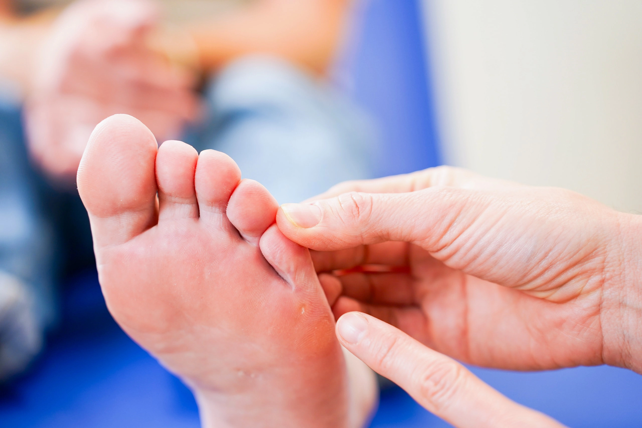 Externe validatie van een predictiemodel van valincidenten in de podotherapie praktijk